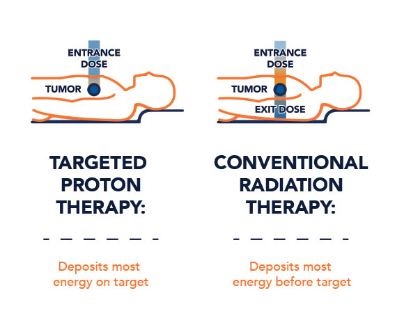 proton therapy vs conventional radiation therapy