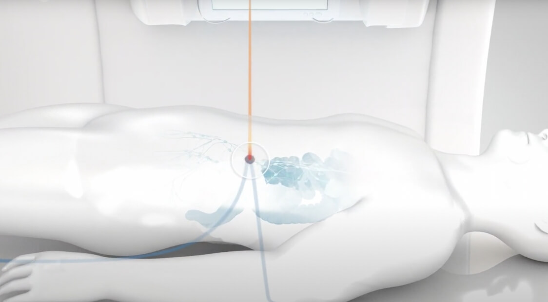 difference between proton radiation and radiation therapy